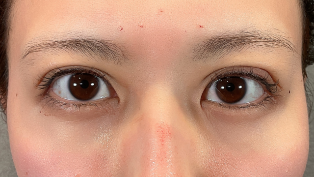 Postoperative Condition Part 1