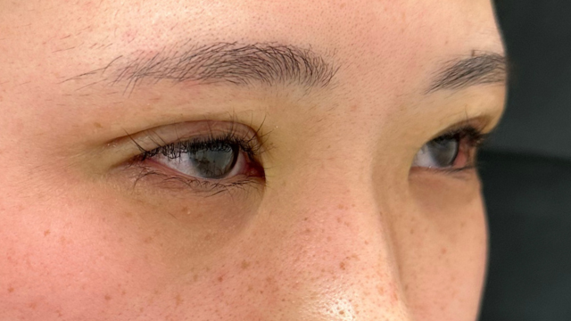 Postoperative Condition Part 1