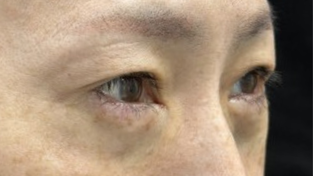 Postoperative Condition Part 1