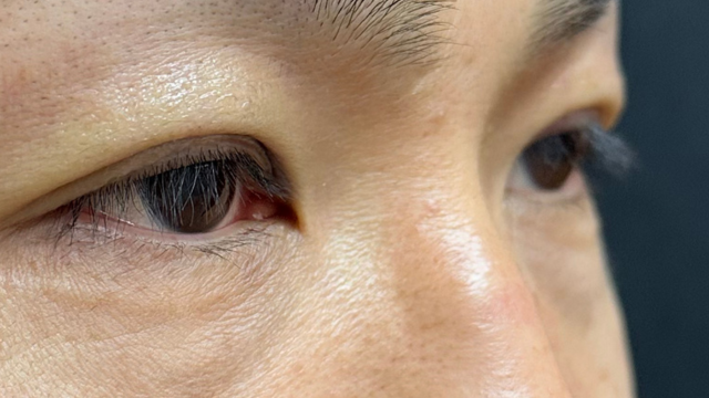 Postoperative Condition Part 1