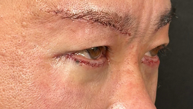 Postoperative Condition Part 1