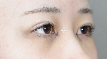 Postoperative Condition Part 1