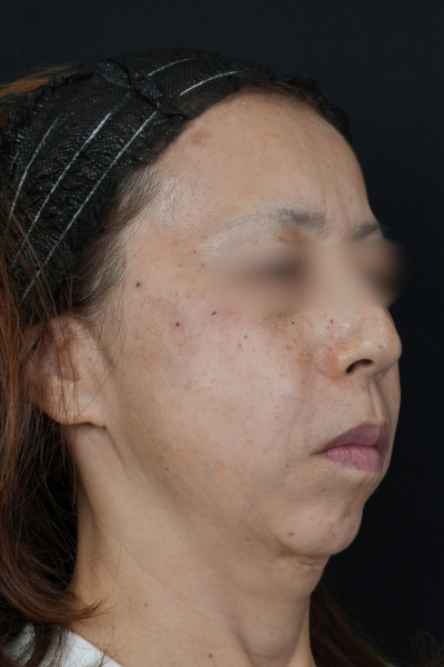 Postoperative Condition Part 1