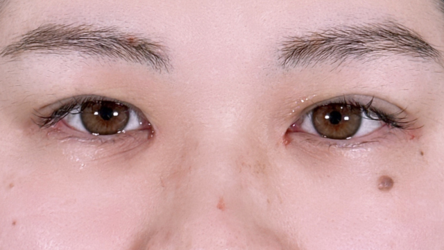 Postoperative Condition Part 1