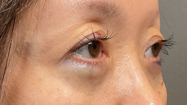 Postoperative Condition Part 1