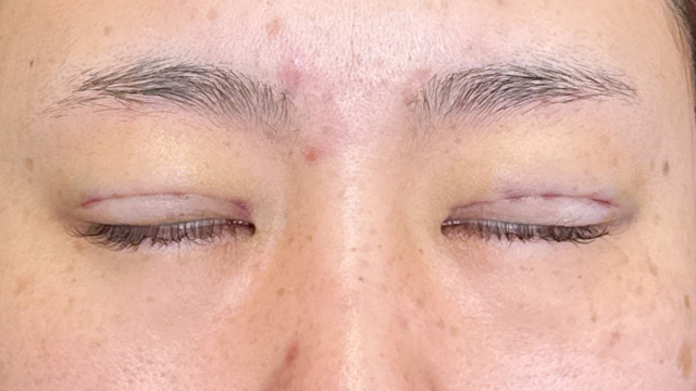 Postoperative Condition Part 1