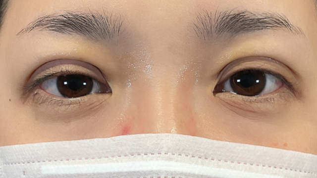 Postoperative Condition Part 1