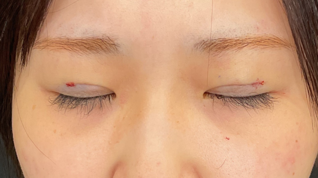 Postoperative Condition Part 1