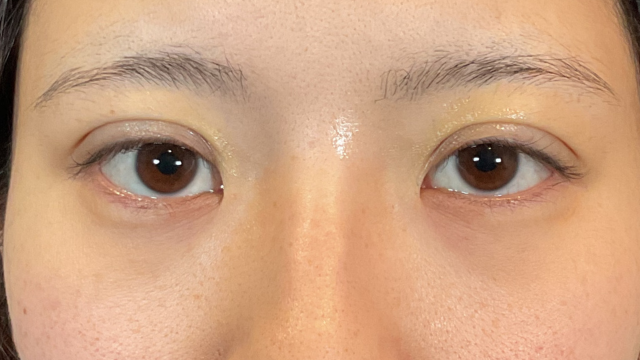 Postoperative Condition Part 1