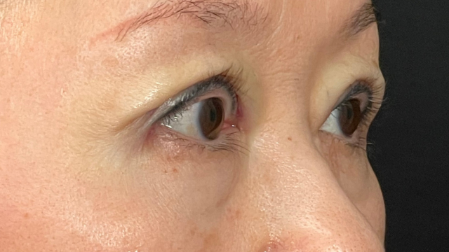 Postoperative Condition Part 1