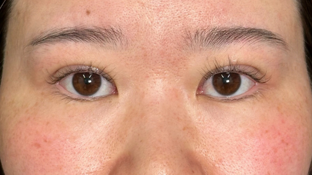 Postoperative Condition Part 1