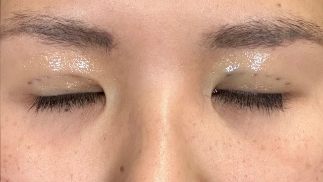 Postoperative Condition Part 1