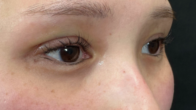 手术前的状态 其一