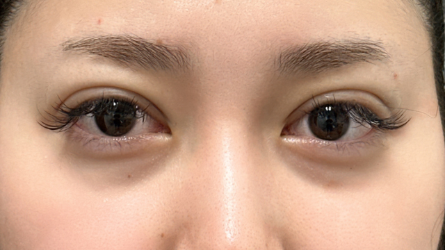 Postoperative Condition Part 1