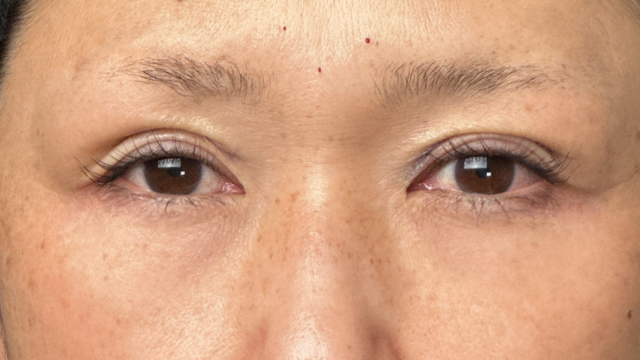 Postoperative Condition Part 1