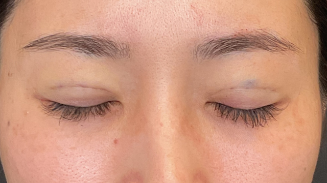 Postoperative Condition Part 1