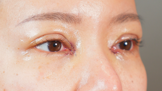 Postoperative Condition Part 1