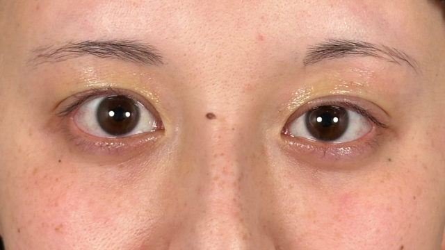 Postoperative Condition Part 1