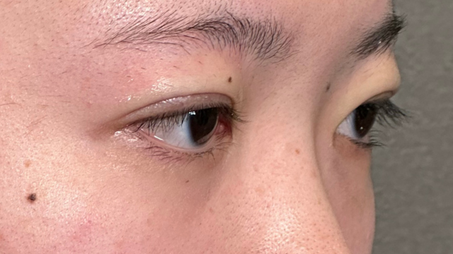 Postoperative Condition Part 1