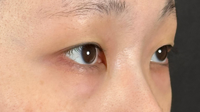 Postoperative Condition Part 1