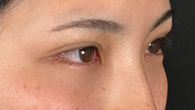 Postoperative Condition Part 1