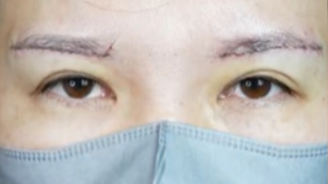 Postoperative Condition Part 1