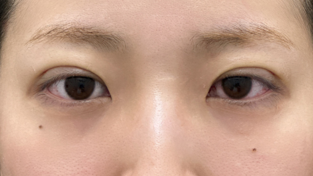 Postoperative Condition Part 1