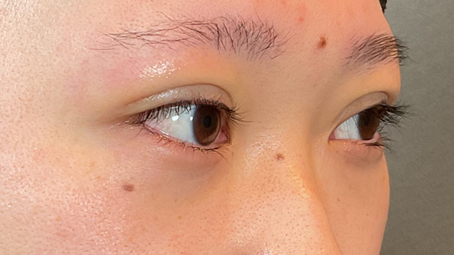 Postoperative Condition Part 1