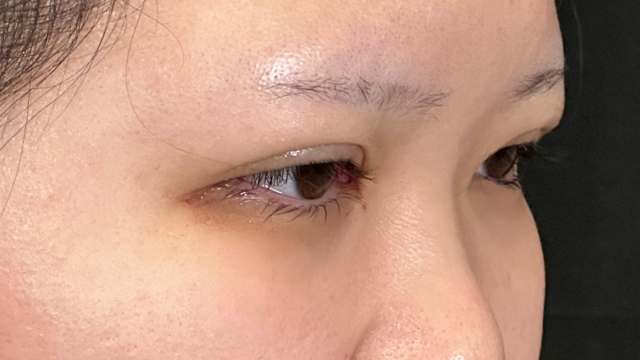 Postoperative Condition Part 1