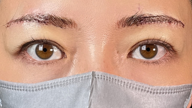 Postoperative Condition Part 1