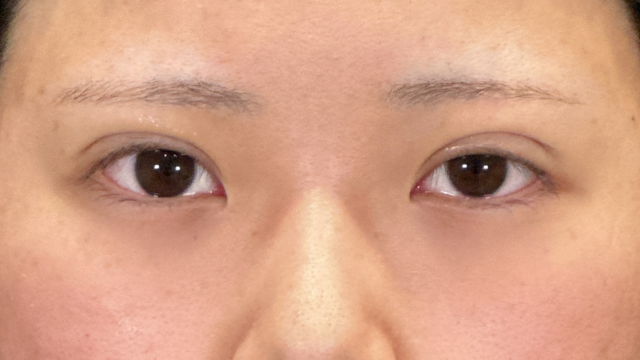 Postoperative Condition Part 1