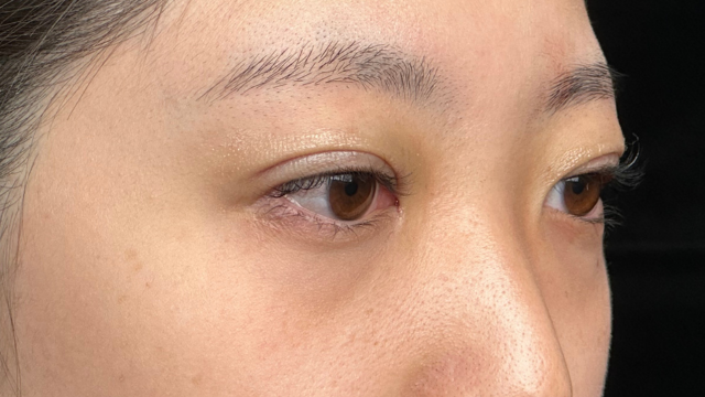 Postoperative Condition Part 1