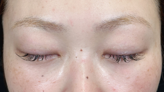 Postoperative Condition Part 1