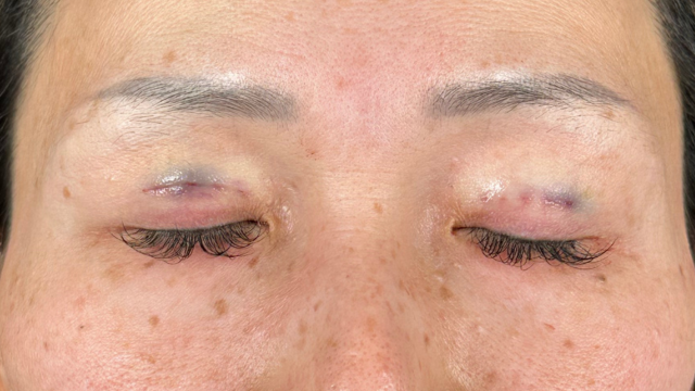 Postoperative Condition Part 1