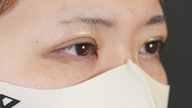 Postoperative Condition Part 1