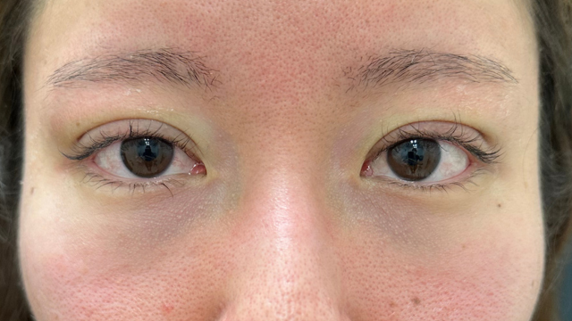 Postoperative Condition Part 1