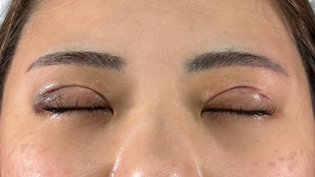 Postoperative Condition Part 1