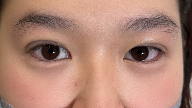 Postoperative Condition Part 1