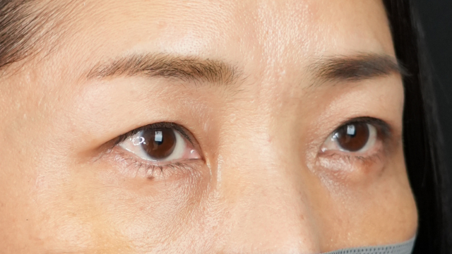 Postoperative Condition Part 1