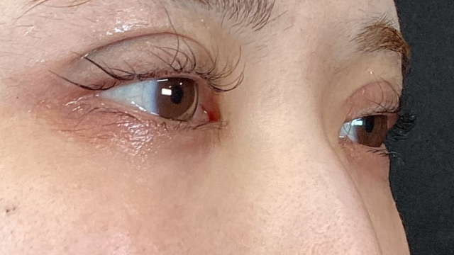 Postoperative Condition Part 1