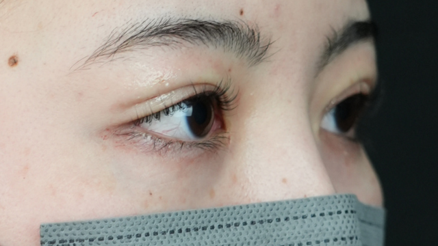 Postoperative Condition Part 1