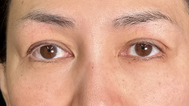 Postoperative Condition Part 1