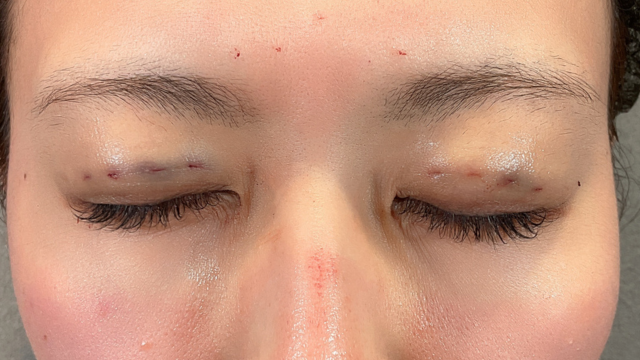 Postoperative Condition Part 1