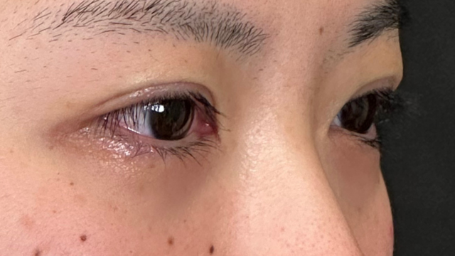 Postoperative Condition Part 1