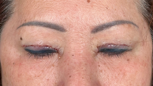 Postoperative Condition Part 1