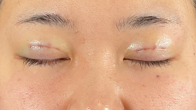 Postoperative Condition Part 1