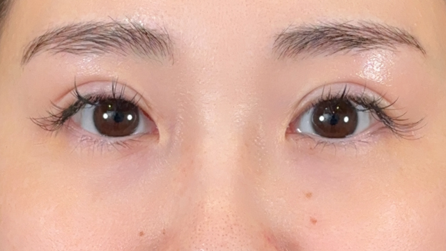 Postoperative Condition Part 1