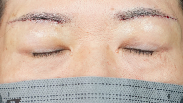 Postoperative Condition Part 1