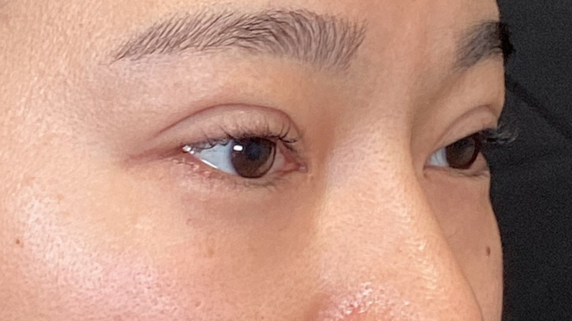 Postoperative Condition Part 1