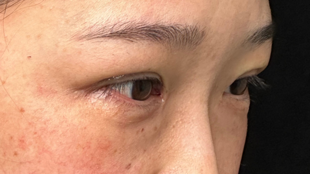 Postoperative Condition Part 1